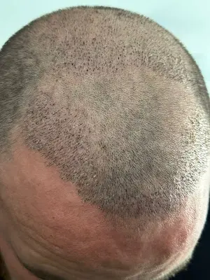 Foto von Aura Ästhetik und Haarklinik - Schönheitsklinik in Oldenburg