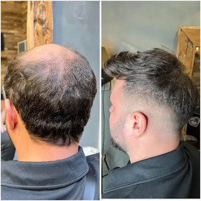 Foto von BEAUTEX® Hairsystems - Toupets & Haarsysteme