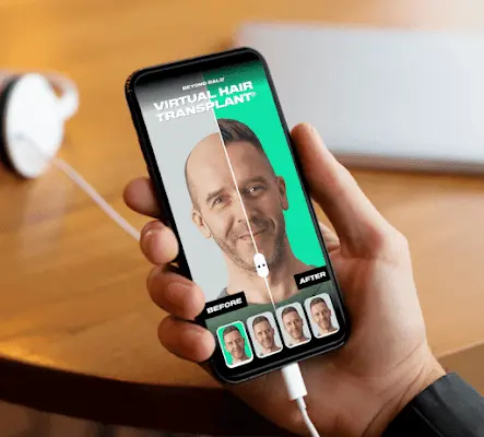 Foto von Beyond Bald GmbH