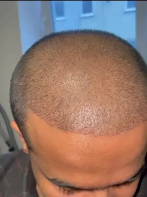 Foto von Estemed Hair