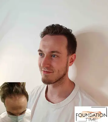 Foto von Foundation Time Haarpigmentierung