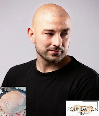 Foundation Time Haarpigmentierung