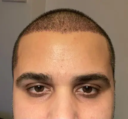 Foto von Giessen Haar