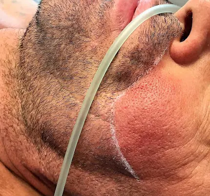 H&H trifft Medizin GmbH - Haarentfernung & Haarausfall Ludwigsburg