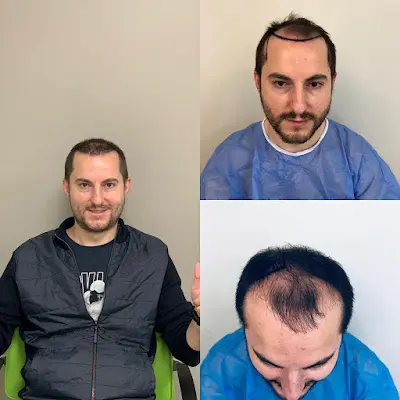 Foto von Hair Clinic Frankfurt