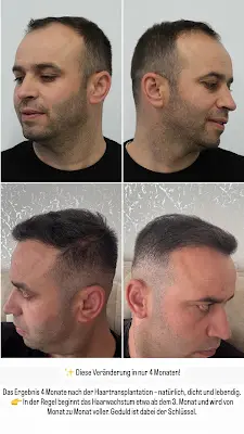 Foto von Hair Team Deutschland