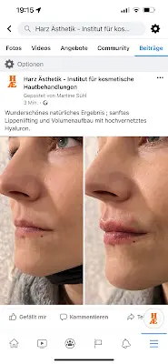 Foto von Harz Ästhetik