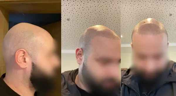 Foto von klassik Haarpigmentierung