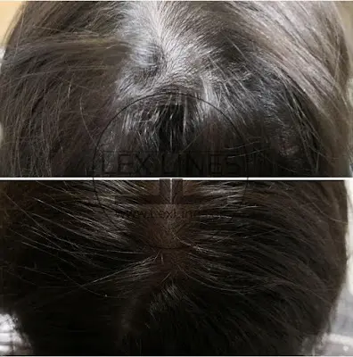 Foto von Lex Lines Haarpigmentierung Stuttgart