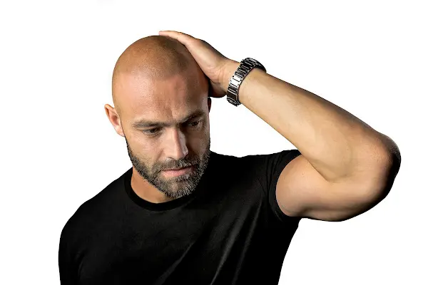 Foto von Mister Scalp - Haarpigmentierung Berlin