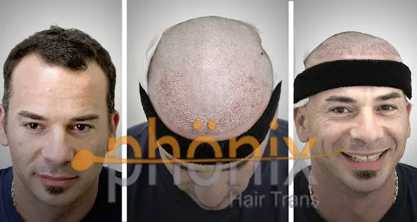 Foto von Phönix Hair Trans GmbH