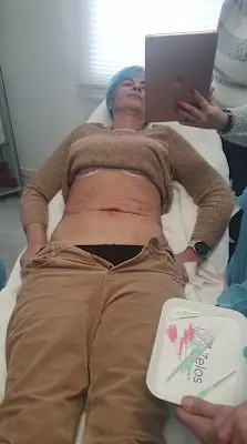 Foto von Praxis Graf für Faltenunterspritzung Moers