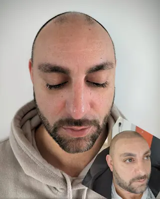 Foto von Scalp-Sensation & BeautyPoint Monika Lung